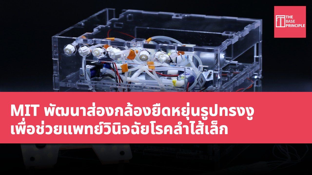 MIT พัฒนาส่องกล้องยืดหยุ่นรูปทรงงู เพื่อช่วยแพทย์วินิจฉัยโรคลำไส้เล็ก