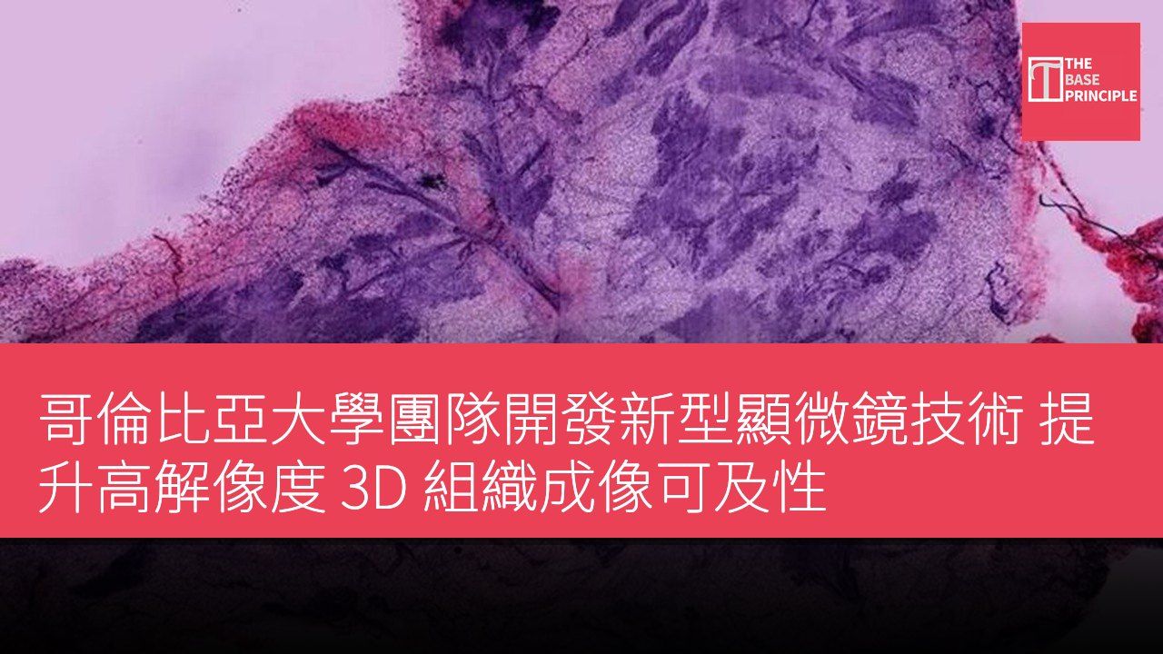 哥倫比亞大學團隊開發新型顯微鏡技術 提升高解像度 3D 組織成像可及性